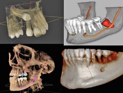 Radiografía Cone Beam dental